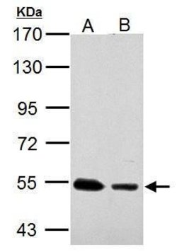 Invitrogen SSB Polyclonal Antibody 100 &mu;L; Unconjugated:Antibodies,