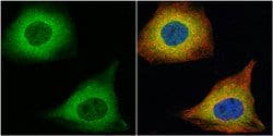 Invitrogen TAGLN Polyclonal Antibody 100 &mu;L; Unconjugated:Antibodies,