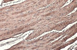 Invitrogen TAGLN Polyclonal Antibody 100 &mu;L; Unconjugated:Antibodies,