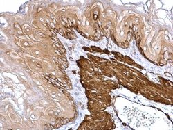 Invitrogen TAGLN Polyclonal Antibody 100 &mu;L; Unconjugated:Antibodies,