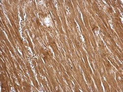 Invitrogen TAGLN Polyclonal Antibody 100 &mu;L; Unconjugated:Antibodies,