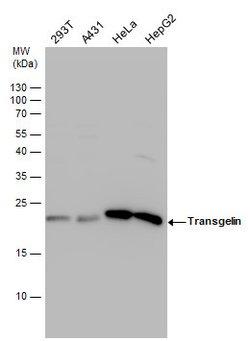 Invitrogen TAGLN Polyclonal Antibody 100 &mu;L; Unconjugated:Antibodies,