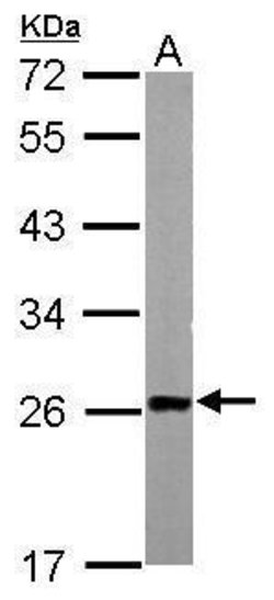 Invitrogen TAGLN Polyclonal Antibody 100 &mu;L; Unconjugated:Antibodies,
