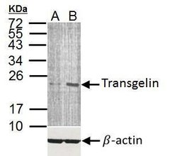 Invitrogen TAGLN Polyclonal Antibody 100 &mu;L; Unconjugated:Antibodies,