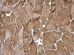 Invitrogen TPM3 Polyclonal Antibody 100 &mu;L; Unconjugated:Antibodies,