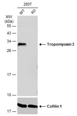 Invitrogen TPM3 Polyclonal Antibody 100 &mu;L; Unconjugated:Antibodies,