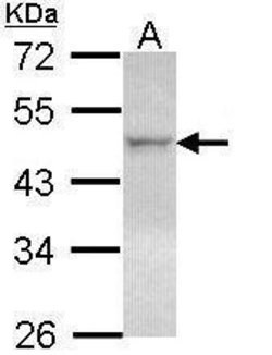 Invitrogen LXR beta Polyclonal Antibody 100 &mu;L; Unconjugated:Antibodies,