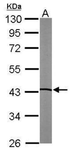 Invitrogen LXR beta Polyclonal Antibody 100 &mu;L; Unconjugated:Antibodies,