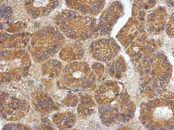 Invitrogen VEGFC Polyclonal Antibody 100 &mu;L; Unconjugated:Antibodies,