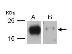 Invitrogen VEGFC Polyclonal Antibody 100 &mu;L; Unconjugated:Antibodies,