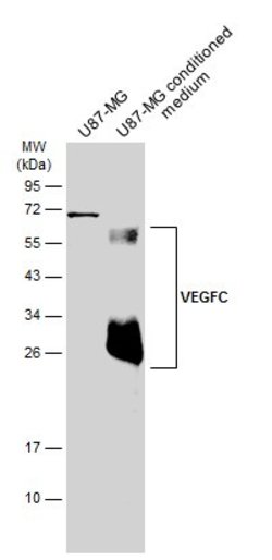 Invitrogen VEGFC Polyclonal Antibody 100 &mu;L; Unconjugated:Antibodies,