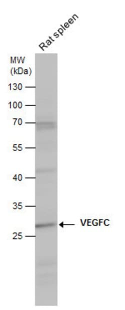 Invitrogen VEGFC Polyclonal Antibody 100 &mu;L; Unconjugated:Antibodies,