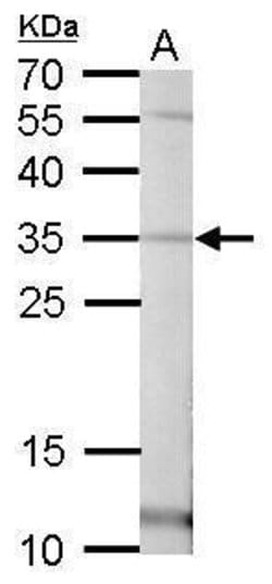 Invitrogen Pirin Polyclonal Antibody 100 &mu;L; Unconjugated:Antibodies,