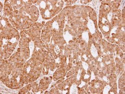 Invitrogen AKR1C3 Polyclonal Antibody 100 &mu;L; Unconjugated:Antibodies,