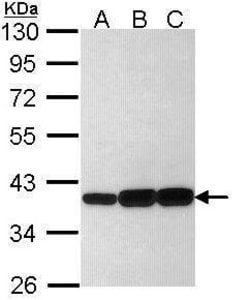 Invitrogen AKR1C3 Polyclonal Antibody 100 &mu;L; Unconjugated:Antibodies,