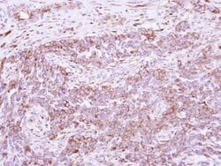 Invitrogen DLC1 Polyclonal Antibody 100 &mu;L; Unconjugated:Antibodies,