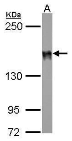 Invitrogen DLC1 Polyclonal Antibody 100 &mu;L; Unconjugated:Antibodies,