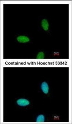 Invitrogen TRAF3IP2 Polyclonal Antibody 100 &mu;L; Unconjugated:Antibodies,