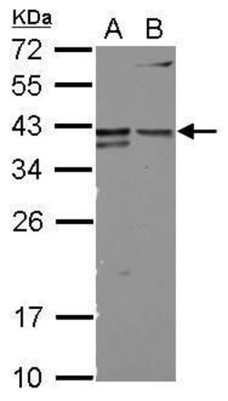 Invitrogen CD147 Polyclonal Antibody 100 &mu;L; Unconjugated:Antibodies,