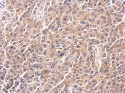 Invitrogen Caspase 4 Polyclonal Antibody 100 &mu;L | Buy Online | Invitrogen&trade; | Fisher Scientific