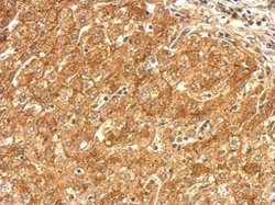 Invitrogen SR-BI Polyclonal Antibody 100 &mu;L; Unconjugated:Antibodies,