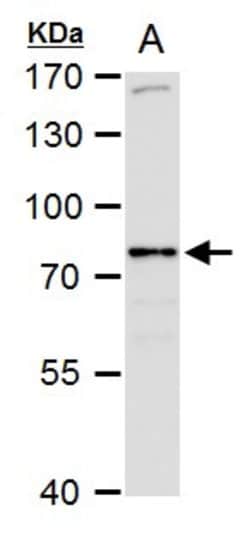 Invitrogen SR-BI Polyclonal Antibody 100 &mu;L; Unconjugated:Antibodies,