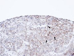 Invitrogen P-cadherin Polyclonal Antibody 100 &mu;L; Unconjugated:Antibodies,