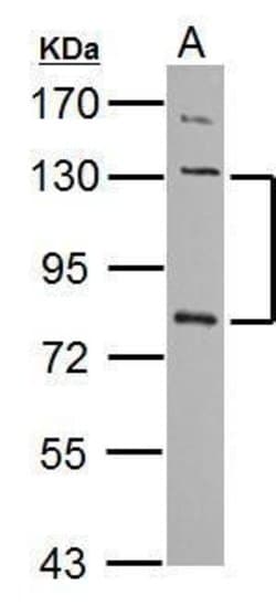 Invitrogen P-cadherin Polyclonal Antibody 100 &mu;L; Unconjugated:Antibodies,