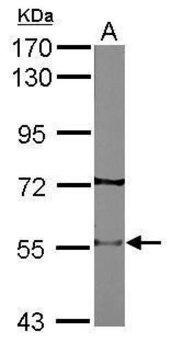 Invitrogen CHRNB2 Polyclonal Antibody 100 &mu;L; Unconjugated:Antibodies,