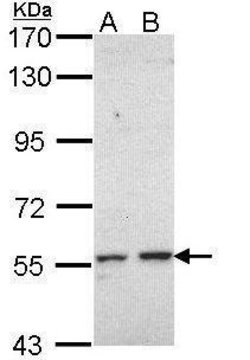 Invitrogen CYP17A1 Polyclonal Antibody 100 &mu;L; Unconjugated:Antibodies,
