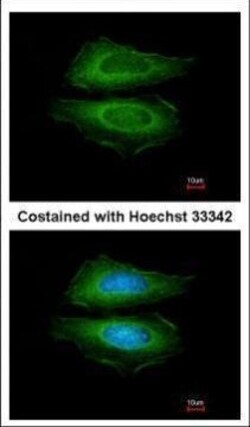 Invitrogen Cortactin Polyclonal Antibody 100 &mu;L | Buy Online | Invitrogen&trade; | Fisher Scientific