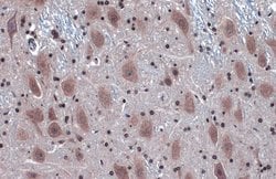Invitrogen IRE1 alpha Polyclonal Antibody 100 &mu;L; Unconjugated:Antibodies,