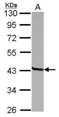 Invitrogen CD23 Polyclonal Antibody 100 &mu;L; Unconjugated:Antibodies,
