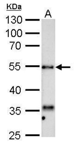 Invitrogen HYAL1 Polyclonal Antibody 100 &mu;L; Unconjugated:Antibodies,