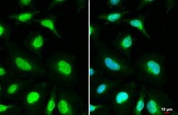 Invitrogen MSH3 Polyclonal Antibody 100 &mu;L; Unconjugated:Antibodies,
