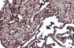Invitrogen MSH3 Polyclonal Antibody 100 &mu;L; Unconjugated:Antibodies,