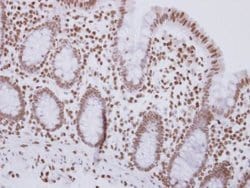 Invitrogen MSH3 Polyclonal Antibody 100 &mu;L; Unconjugated:Antibodies,