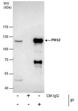 Invitrogen PMS2 Polyclonal Antibody 100 &mu;L | Buy Online | Invitrogen&trade; | Fisher Scientific
