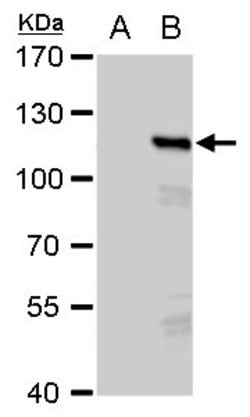 Invitrogen PMS2 Polyclonal Antibody 100 &mu;L; Unconjugated:Antibodies,