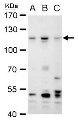 Invitrogen PMS2 Polyclonal Antibody 100 &mu;L; Unconjugated:Antibodies,
