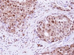 Invitrogen RAD23B Polyclonal Antibody 100 &mu;L; Unconjugated:Antibodies,
