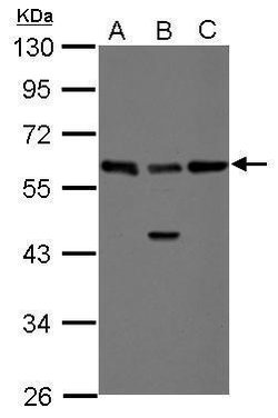 Invitrogen RAD23B Polyclonal Antibody 100 &mu;L; Unconjugated:Antibodies,