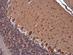 Invitrogen RAP1GAP Polyclonal Antibody 100 μL; Unconjugated:Antibodies,