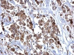 Invitrogen SDHB Polyclonal Antibody 100 &mu;L; Unconjugated:Antibodies,