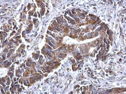 Invitrogen SDHB Polyclonal Antibody 100 &mu;L; Unconjugated:Antibodies,