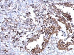 Invitrogen SDHB Polyclonal Antibody 100 &mu;L; Unconjugated:Antibodies,