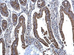 Invitrogen SDHB Polyclonal Antibody 100 &mu;L; Unconjugated:Antibodies,