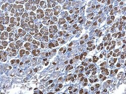 Invitrogen SDHB Polyclonal Antibody 100 &mu;L; Unconjugated:Antibodies,