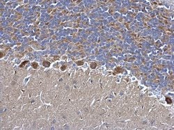 Invitrogen SDHB Polyclonal Antibody 100 &mu;L; Unconjugated:Antibodies,