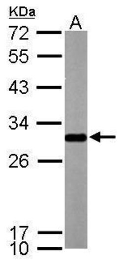 Invitrogen SDHB Polyclonal Antibody 100 &mu;L; Unconjugated:Antibodies,